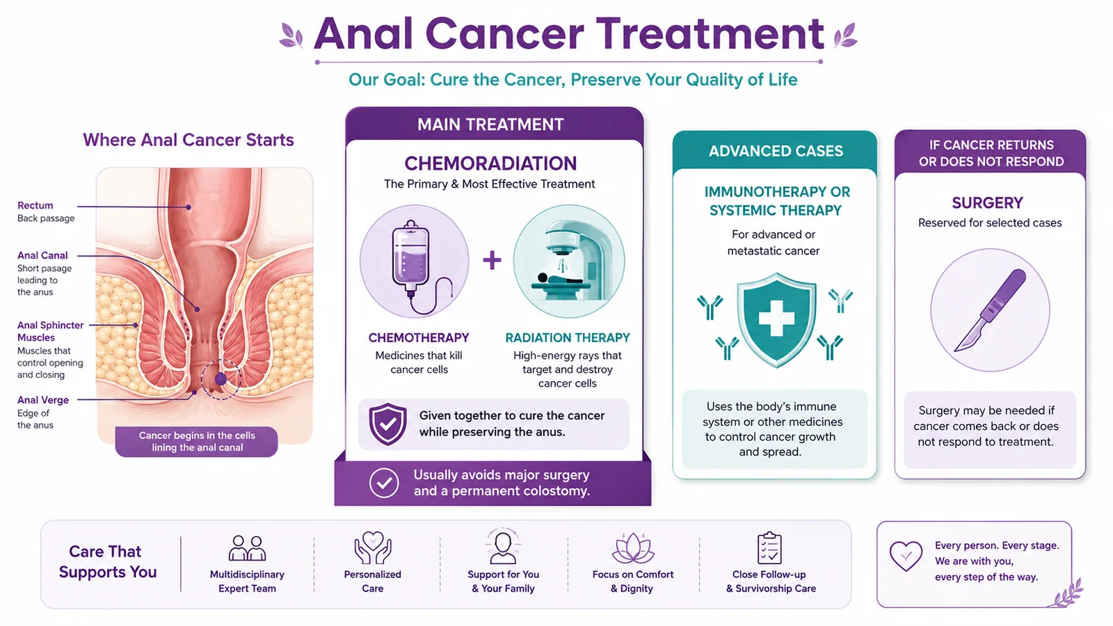 Anal cancer treatment — chemoradiation as the main organ-preserving treatment, with immunotherapy for advanced cases and surgery reserved