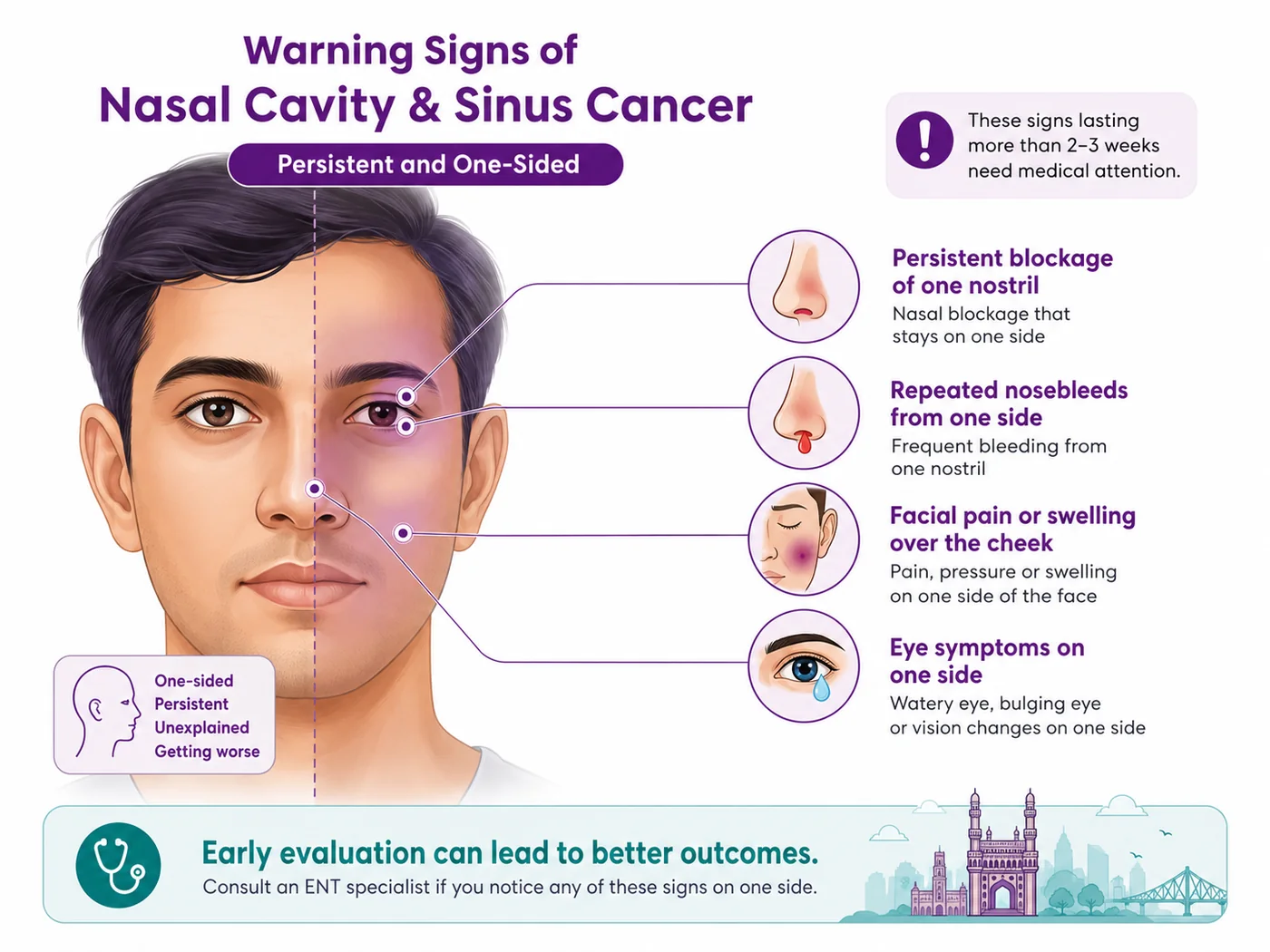 Warning signs of nasal cancer — one-sided blocked nose, nosebleeds, facial swelling and eye symptoms