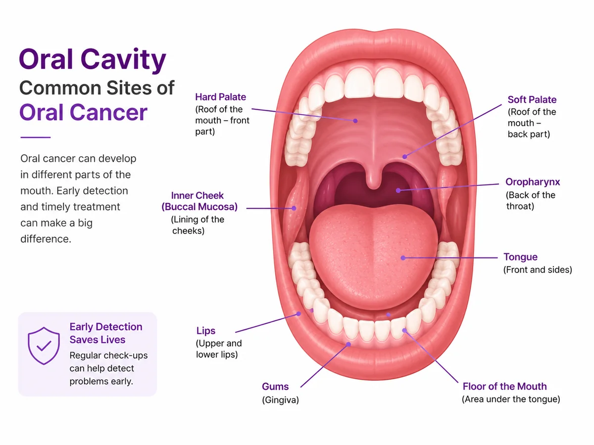 Oral cavity anatomy showing the sites where oral cancer develops — lips, tongue, buccal mucosa, gums, floor of mouth, hard and soft palate and oropharynx