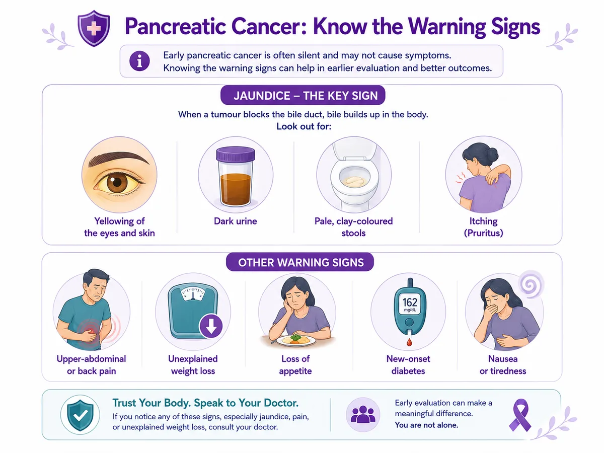 Pancreatic cancer warning signs — jaundice, dark urine and pale stools, back pain, weight loss, new diabetes and loss of appetite