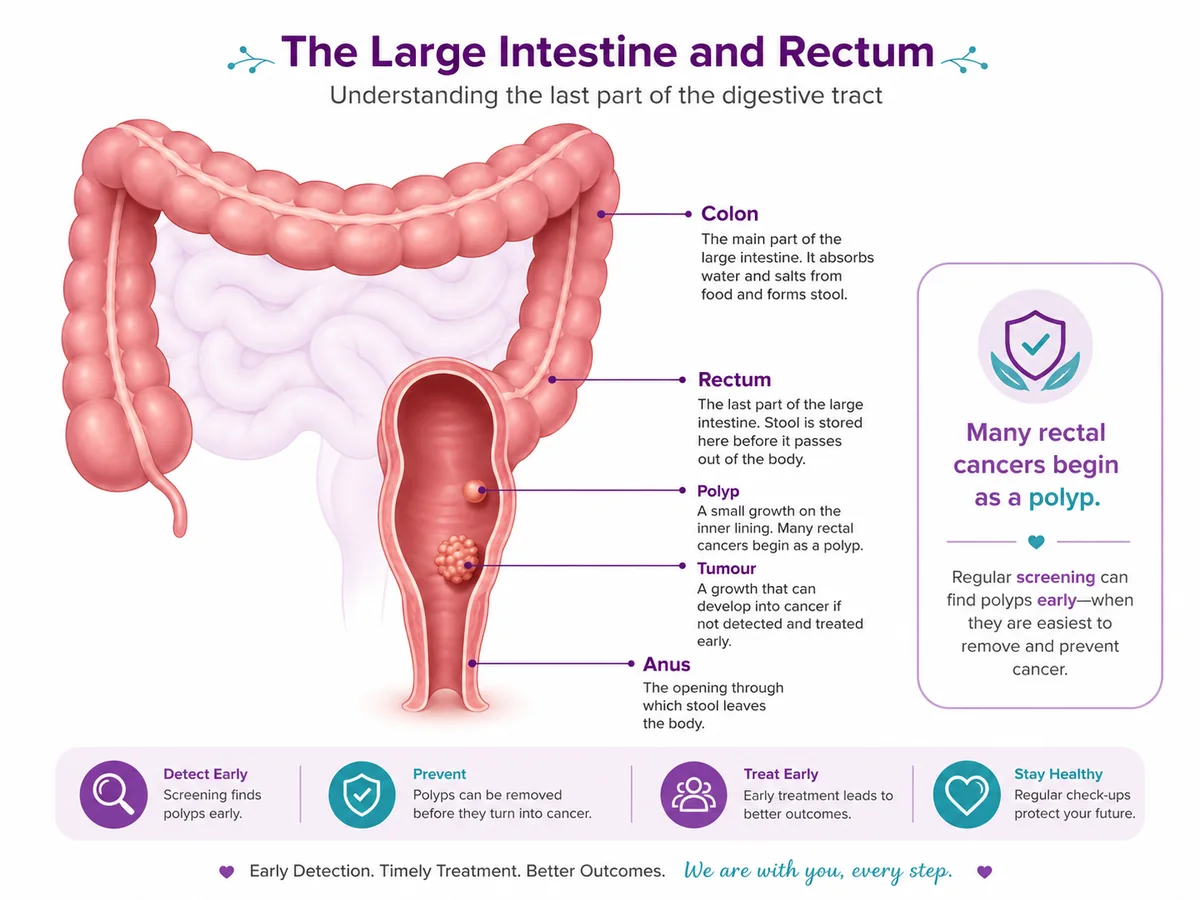 Colon and rectum anatomy showing the rectum, a polyp and where rectal cancer begins