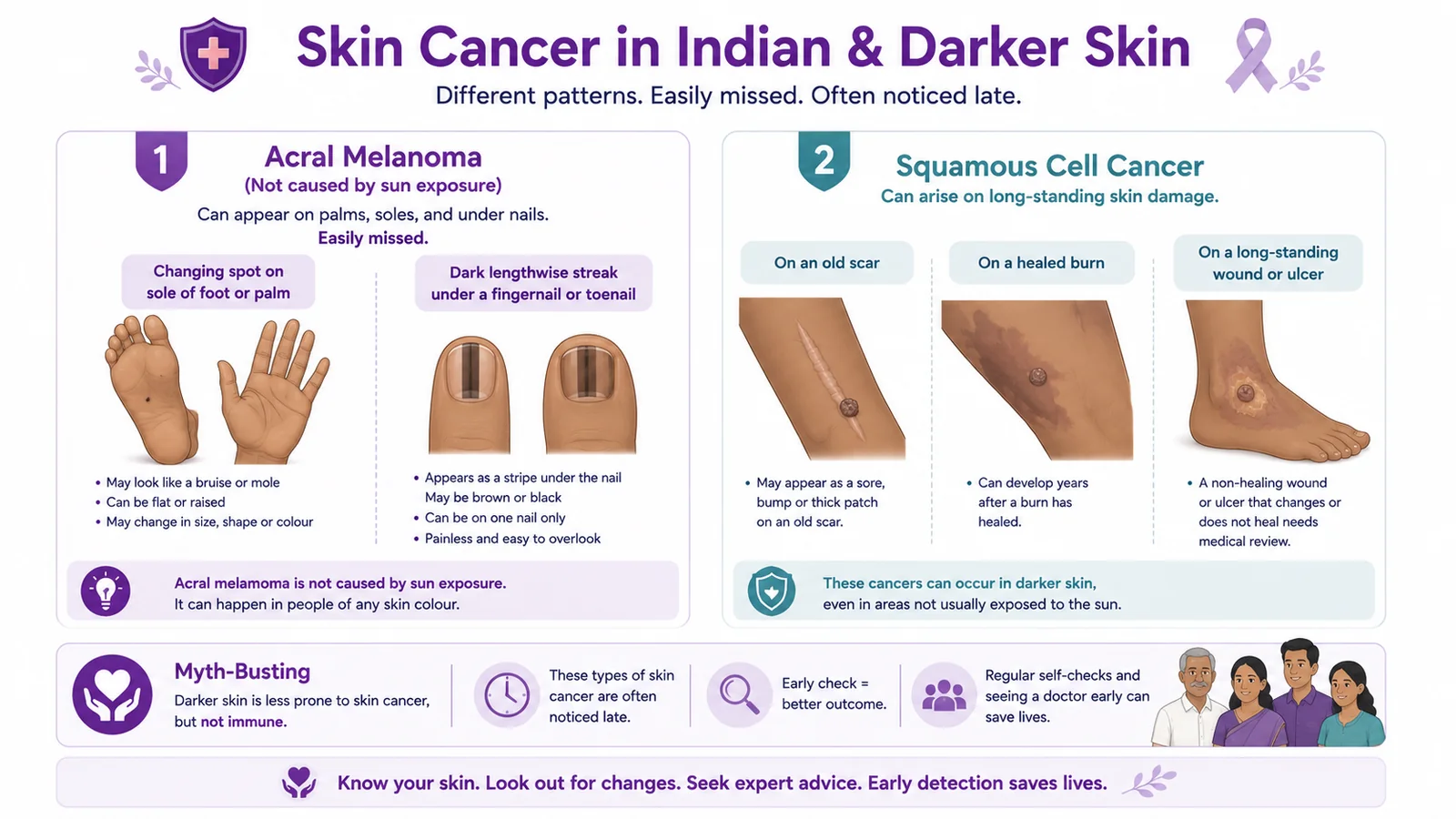 Skin cancer in Indian and darker skin - acral melanoma on soles, palms and nails, and squamous cancer on scars and burns