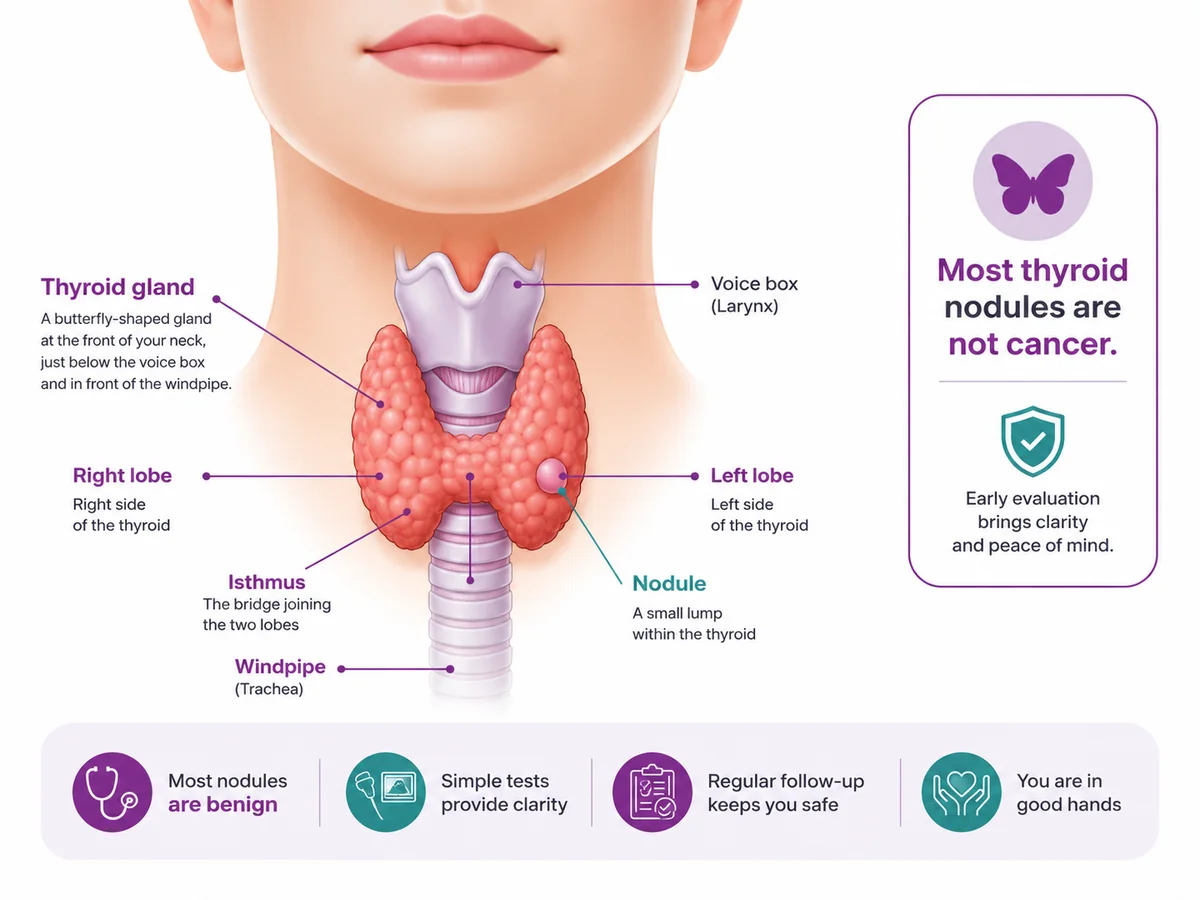 Thyroid gland anatomy in the neck showing the lobes, isthmus and a nodule