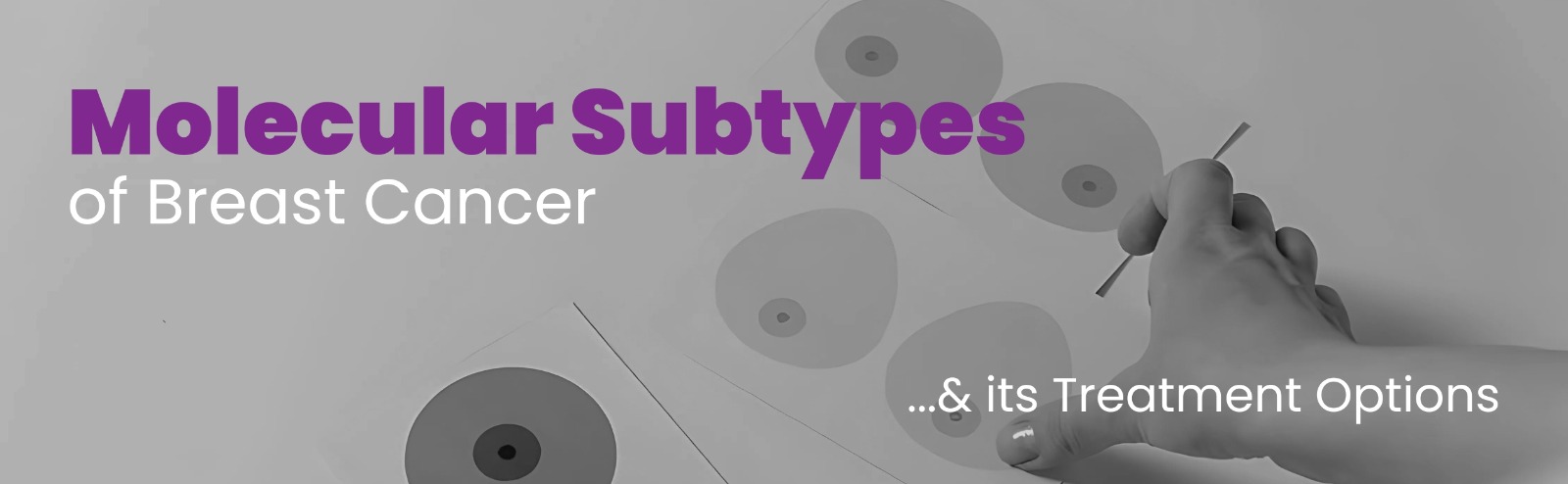 Molecular Subtypes of Breast Cancer & its Treatment Options