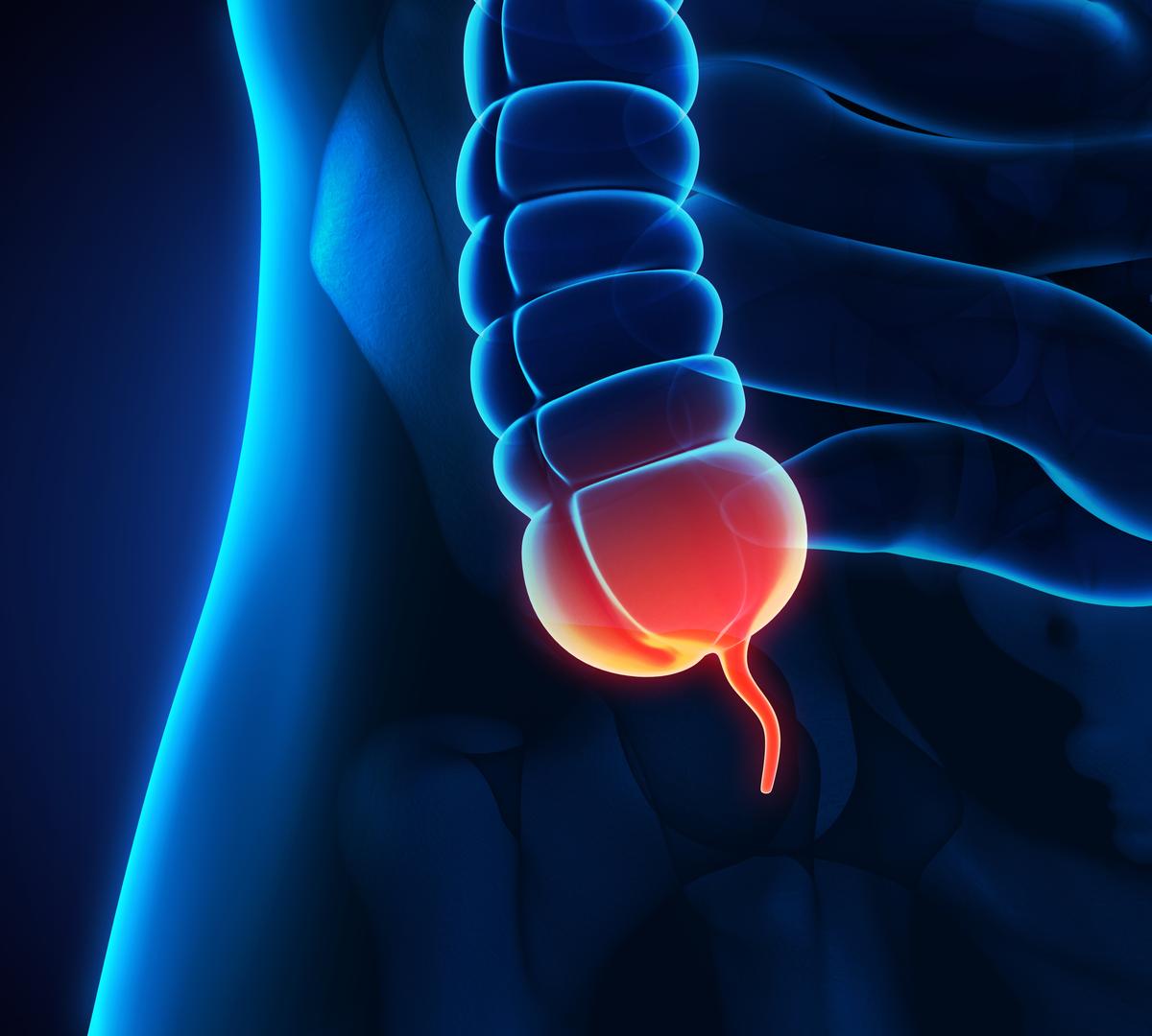 Where does Appendix Cancer Spread?