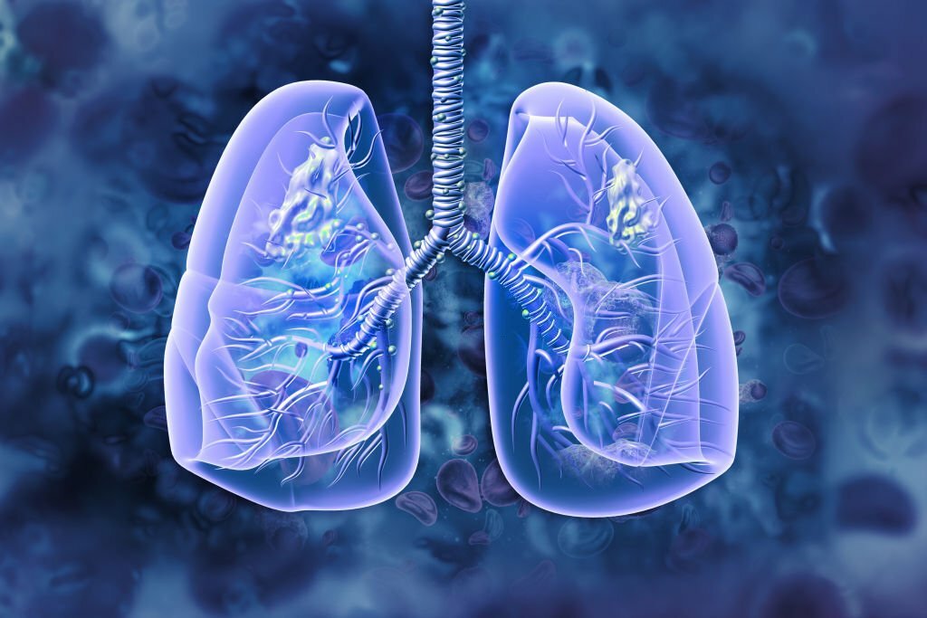 Lung cancer know the occurrence types  risk factors and symptoms